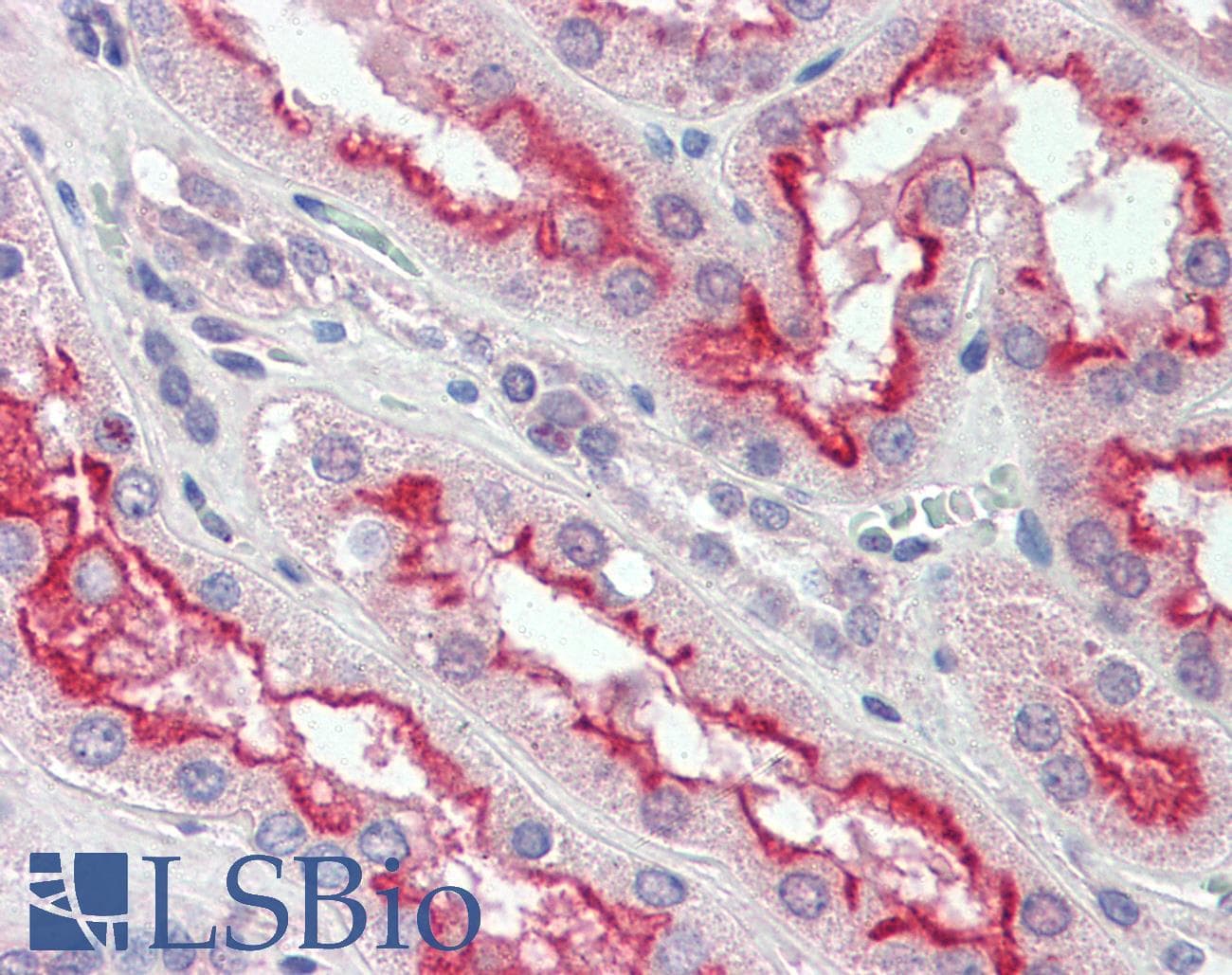 IHC-plus™ Monoclonal Mouse anti-Human FER Antibody (clone 5D2C4, IHC, IF, WB)