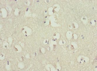 RGS7 Antibody