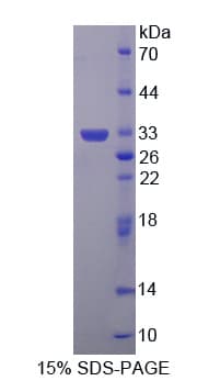 Mouse GLRX3 / Glutaredoxin 3 Protein (Recombinant His-T7)