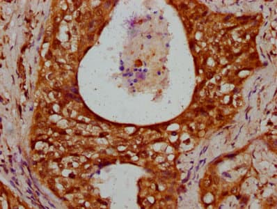 Polyclonal Rabbit anti-Human HIST1H1C Antibody (IHC)