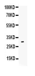 IL17A Antibody (aa26-158)