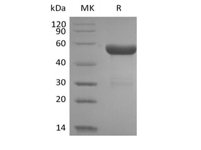 Human Hla-dqa1 gene (dqa1*0201, dqa1*03011 and dqa1*0303) Protein (Recombinant 10His, C-terminus)