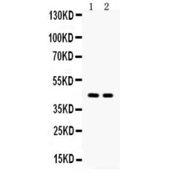 AQP4 / Aquaporin 4 Antibody (aa295-323)