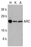 Polyclonal Rabbit anti-Human ARC / Arg3.1 Antibody (IHC, WB)