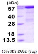 Human PCK1 Protein (Recombinant His)