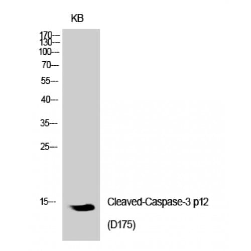 CASP3 / Caspase 3 Antibody (130-210 aa, Internal)