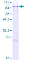 Human ZNF624 Protein (Recombinant GST)