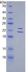 Mouse EDN1 / Endothelin 1 Protein (Recombinant His, N-Terminal)