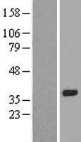 Human RPS2P40 Protein (Over-Expression Lysate Myc-DDK (Flag))