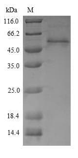 Penaeus monodon CKM / Creatine Kinase MM Protein (Recombinant 6His-SUMO, N-terminus)