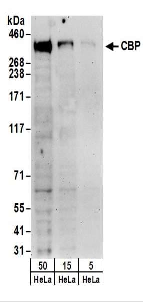 Polyclonal Rabbit anti-Human CREBBP / CREB Binding Protein Antibody (aa2375-2425, IHC, WB)