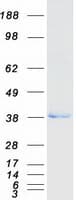 Human Esterase D / ESD Protein (Recombinant Myc-DDK (Flag))