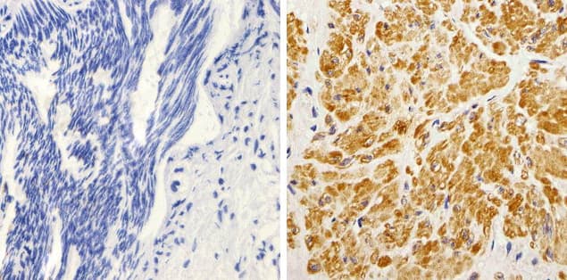 Monoclonal Mouse anti-Human KRAS Antibody (clone 9.13, C-Terminus, IHC, IF, WB)