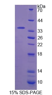 Human IRS2 / IRS-2 Protein (Recombinant His, N-Terminal)