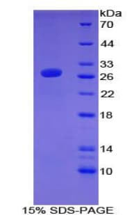 Mouse ATF7 Protein (Recombinant His-T7)