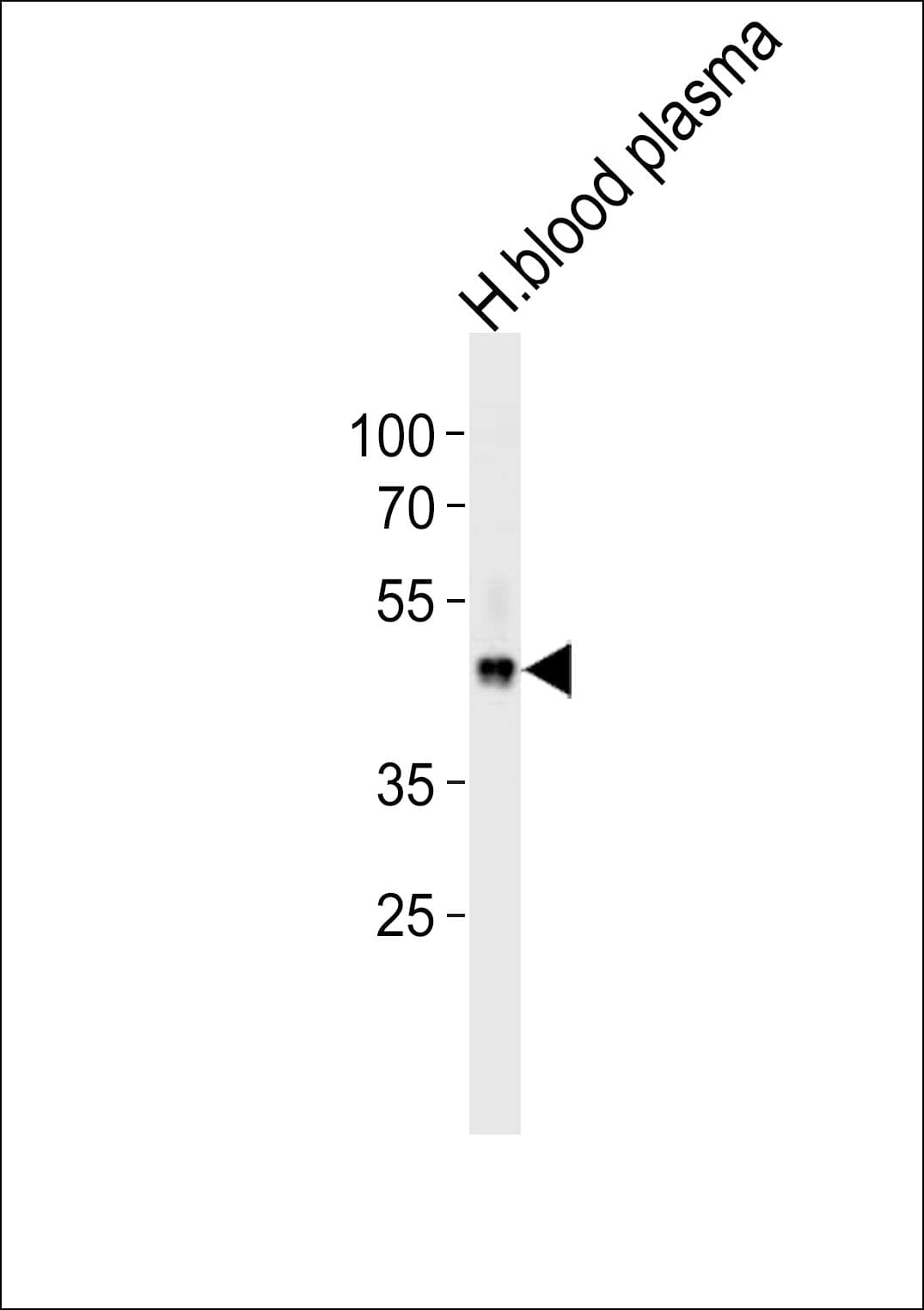 FGG / Fibrinogen Gamma Antibody (aa417-445)