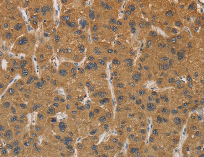 CYP17 / CYP17A1 Antibody