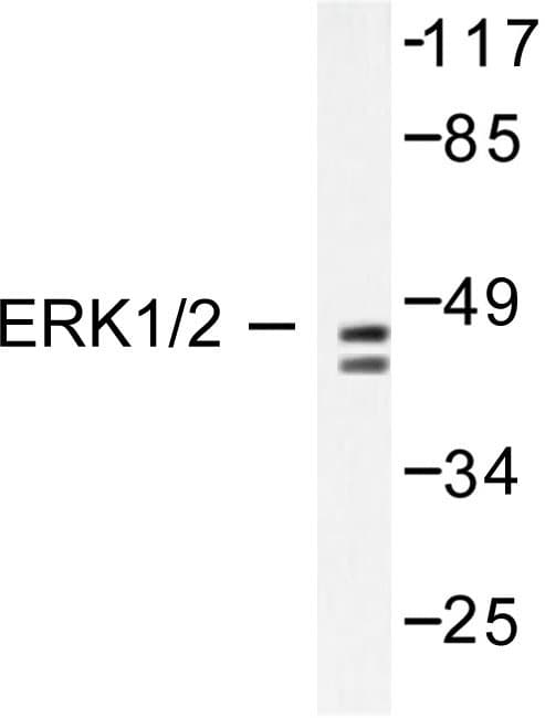 ERK1 + ERK2 Antibody (Leu352)