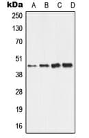 Polyclonal Rabbit anti-Human ALDH3B2 Antibody (C-Terminus, WB)