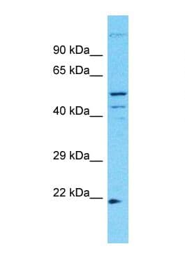 TMEM145 Antibody (aa77-126)