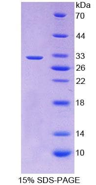 Human RARB / RAR Beta Protein (Recombinant His, N-Terminal)