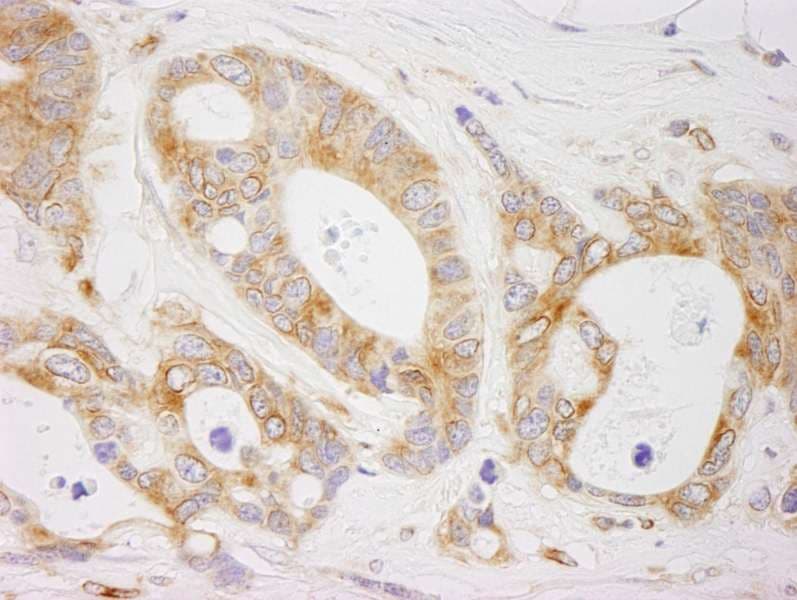 EML4 Antibody (aa931-981)