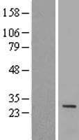 IQCF1 Protein (Over-Expression Lysate Myc-DDK (Flag))