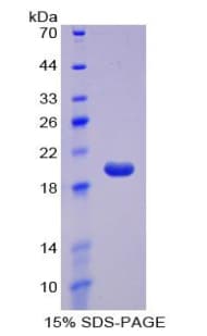 Mouse NK1 / CD160 Protein (Recombinant His-T7)