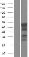 CHKB / CHKL Protein (Over-Expression Lysate Myc-DDK (Flag))