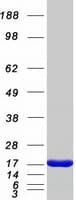 Human CLC Protein (Recombinant Myc-DDK (Flag))
