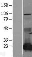 CMPK / CMPK1 Protein (Over-Expression Lysate Myc-DDK (Flag))