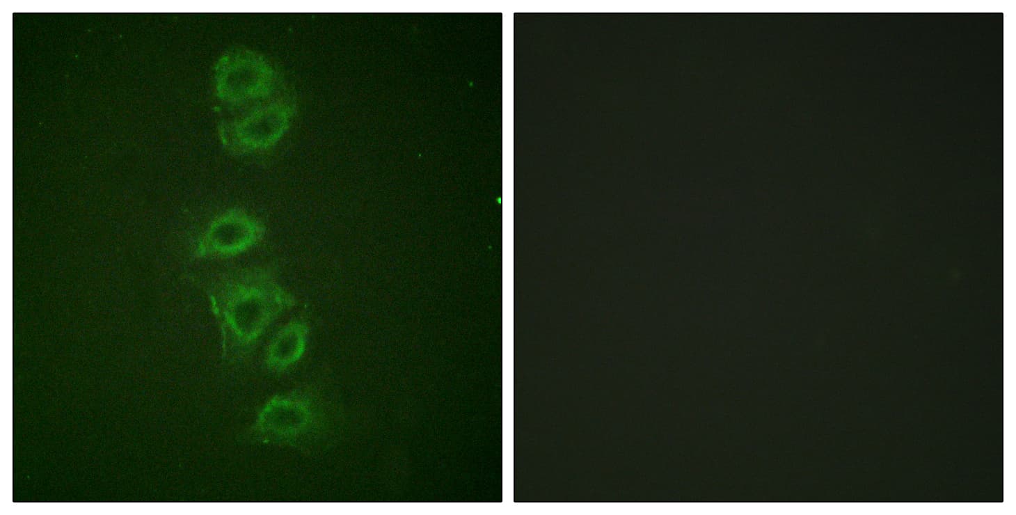 PP2Ac / PPP2CA Antibody (phospho-Tyr307)