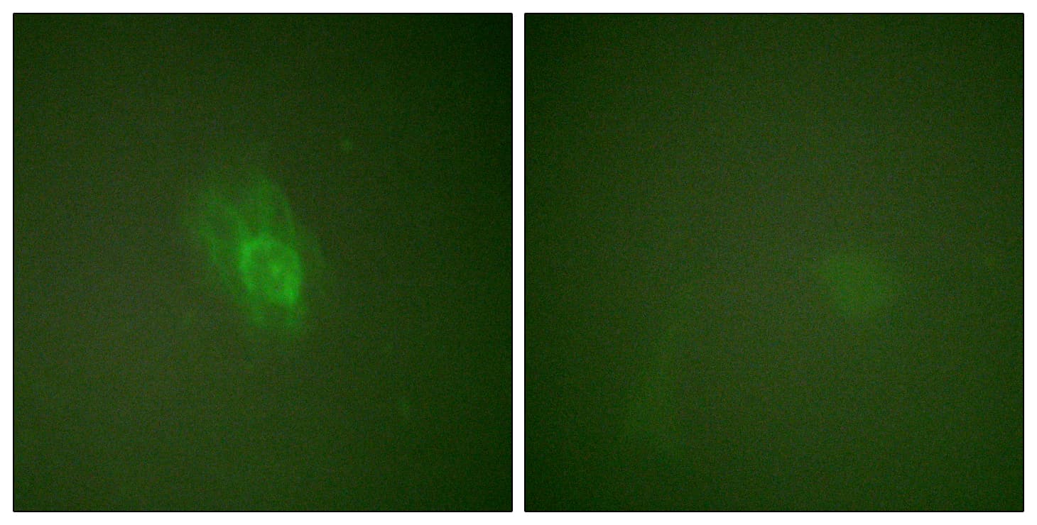 NFKBIB / IKB Beta / IKBB Antibody (phospho-Ser23)