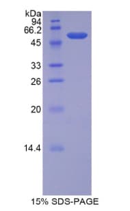 Human CEL / Carboxyl Ester Lipase Protein (Recombinant His-GST)