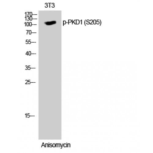 Polyclonal Rabbit anti-Human PRKD1 / PKC Mu Antibody (140-220 aa, IHC, WB)