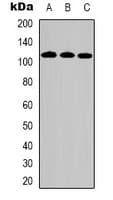 Polyclonal Rabbit anti-Human DPYD / DPD Antibody (Internal, WB)