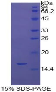 Bovine LGALS9 / Galectin 9 Protein (Recombinant His)