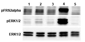 Human FGF21 Protein (Recombinant Human IgG1 Fc)