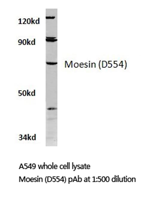 MSN / Moesin Antibody (Asp554)