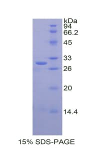 Human CTSC / Cathepsin C / JP Protein (Recombinant His)