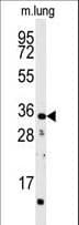 CTDSP2 Antibody (aa12-42)