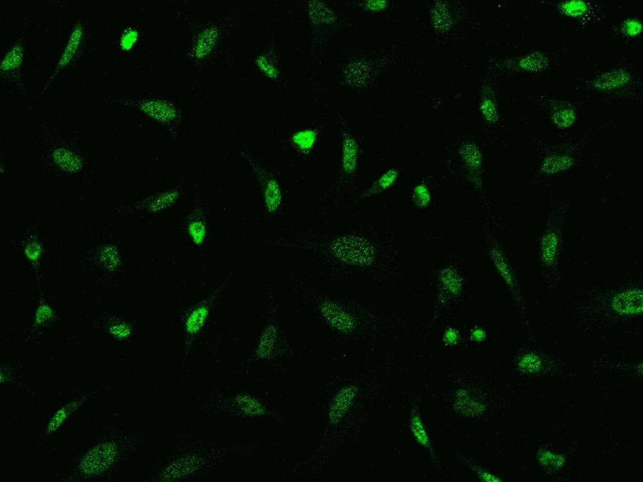 APCS / Serum Amyloid P / SAP Antibody (Preservative Free)