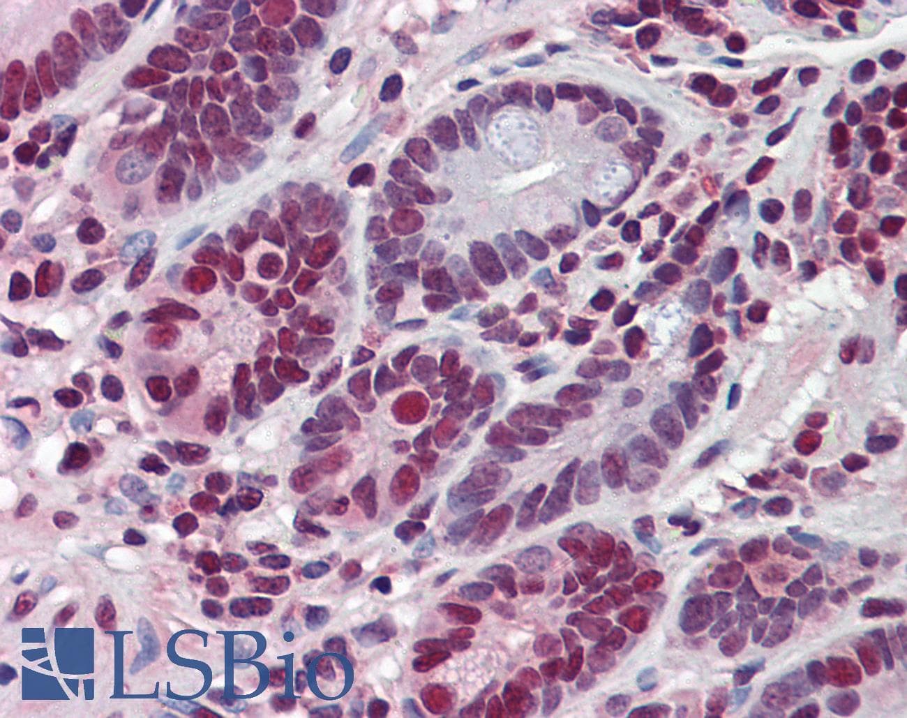 IHC-plus™ Monoclonal Mouse anti-Human HDAC1 Antibody (clone 5C11, IHC, IF, WB)