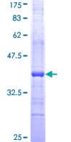 Human CASP2 / Caspase 2 Protein (Recombinant GST, N-terminus)