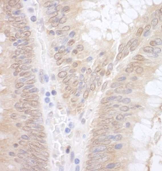 EAF2 / U19 Antibody (aa150-200)
