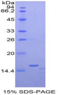 Mouse OCM / Oncomodulin Protein (Recombinant His-T7)