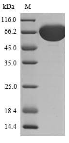 Human FGFR1 / FGF Receptor 1 Protein (Recombinant 6His-SUMOstar, N-terminus)
