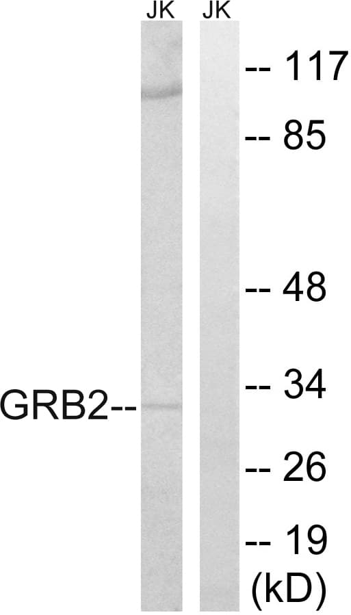 GRB2 Antibody (aa141-190)