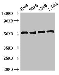 Polyclonal Rabbit anti-Staphylococcus aureus LDHA / LDH1 Antibody