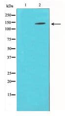 Polyclonal Rabbit anti-Human BCAR1 / p130Cas Antibody (IHC, WB)